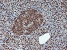 HDHD1 Antibody (clone OTI7A2)