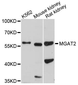 Polyclonal Rabbit anti-Human MGAT2 Antibody (WB)