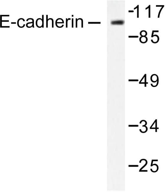 CDH1 / E Cadherin Antibody (Gly2)