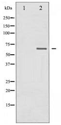 NF2 / Merlin Antibody