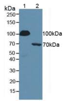 SERPING1 / C1 Inhibitor Antibody (aa399-500)