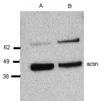 Monoclonal Mouse anti-Human PRF1 / Perforin Antibody (clone BOR21, WB)