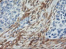 Monoclonal Mouse anti-Human CNN2 Antibody (clone OTI2B5, IHC, IF, WB)
