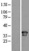 TOR1A / Torsin A Protein (Over-Expression Lysate Myc-DDK (Flag))