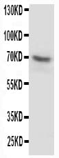 P2RX7 / P2X7 Antibody (aa1-20)