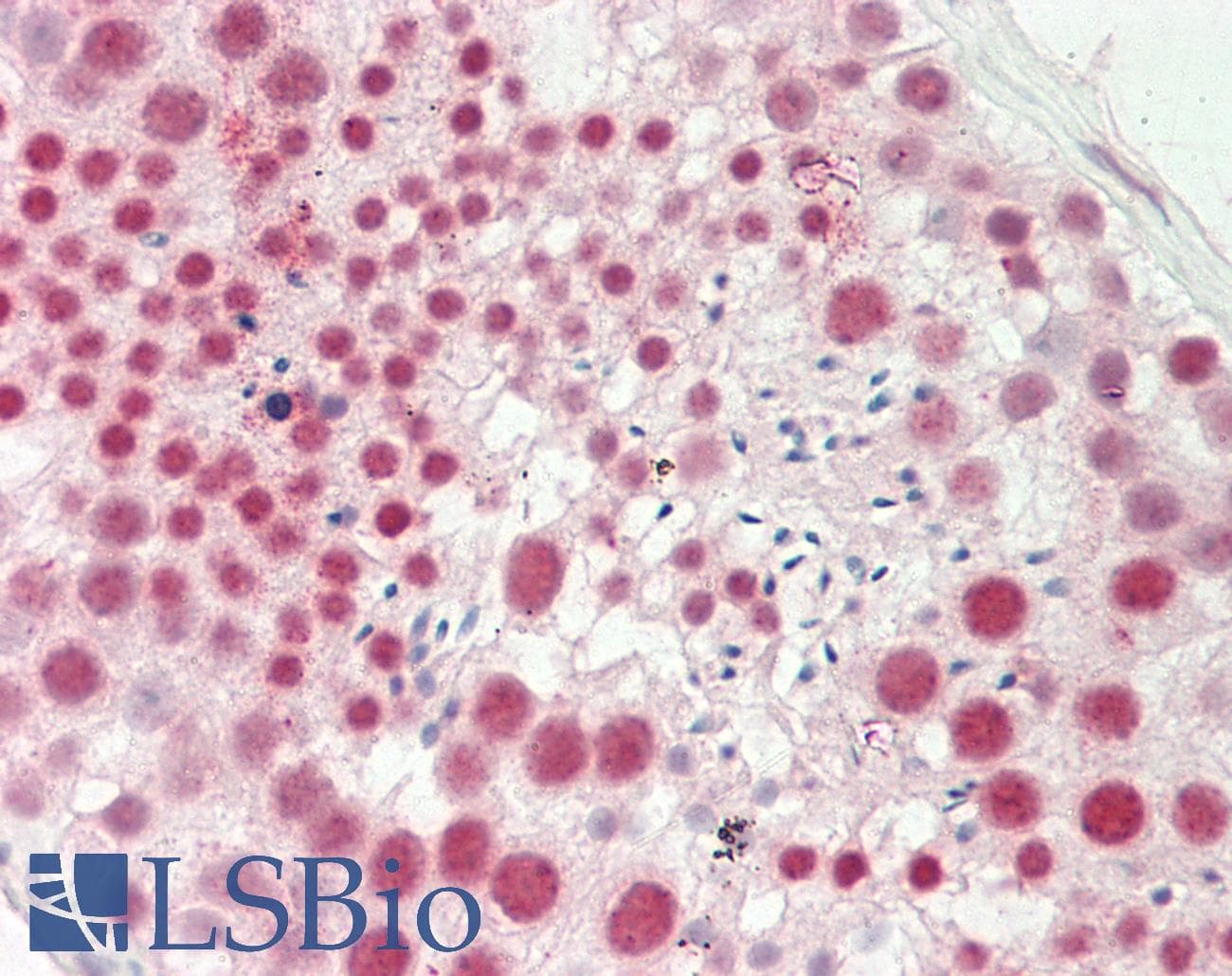 HMG2 / HMGB2 Antibody (aa107-156)