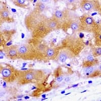SCYL1 / NTKL Antibody