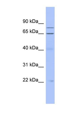 Polyclonal Rabbit anti-Human ZNF431 Antibody (C-Terminus, WB)