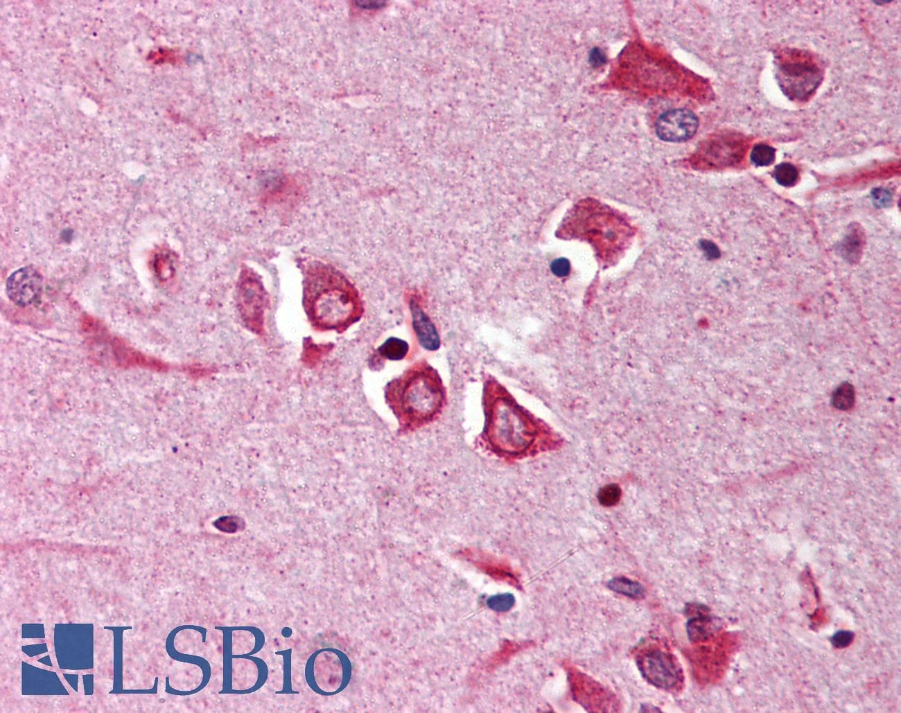 IHC-plus™ Polyclonal Rabbit anti-Human NGFRAP1 / NADE / Bex Antibody (IHC, WB)