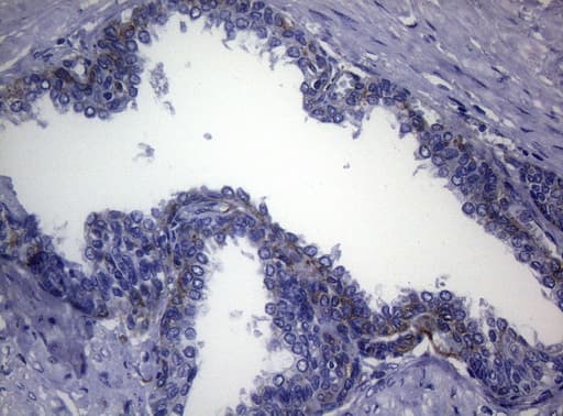 CTSL / Cathepsin L Antibody (clone OTI6B8)