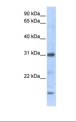 Polyclonal Rabbit anti-Human CXCL16 Antibody (Biotin, C-Terminus, WB)