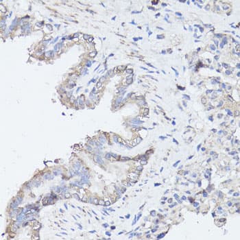 MAP1LC3B / LC3B Antibody