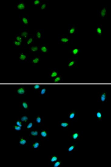 IHC-plus™ AML1 / RUNX1 Antibody (aa150-250)