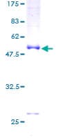 Human TNNI1 Protein (Recombinant GST)