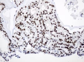 PCNA Antibody (clone OTI1H10)