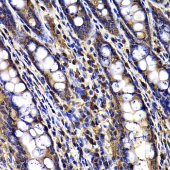 Polyclonal Rabbit anti-Human ARID3A / DRIL1 Antibody (IHC, WB)