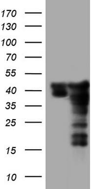 Monoclonal Mouse anti-Human SAE1 Antibody (clone OTI6B11, IHC, WB)