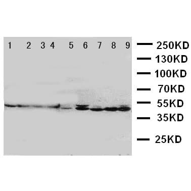 DNAJA1 / HDJ2 Antibody (aa369-384)