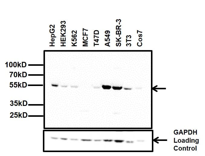 Monoclonal Mouse anti-Human ALDH2 Antibody (clone 4G6A3, Amino Acid: 317-517, IHC, IF, WB)