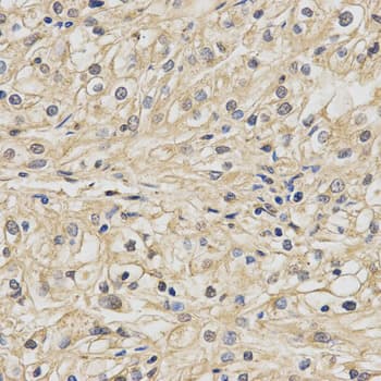 IHC-plus™ NDUFA13 / GRIM19 Antibody