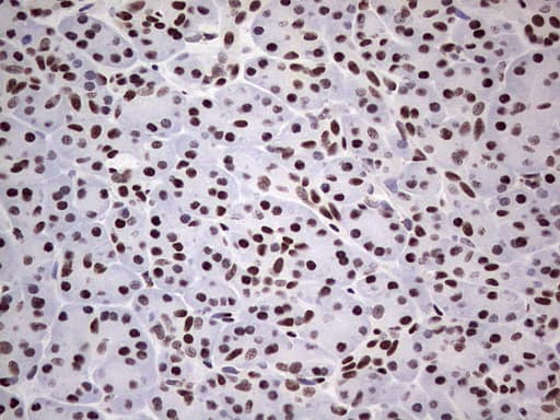 SAE1 Antibody (clone OTI3C3)