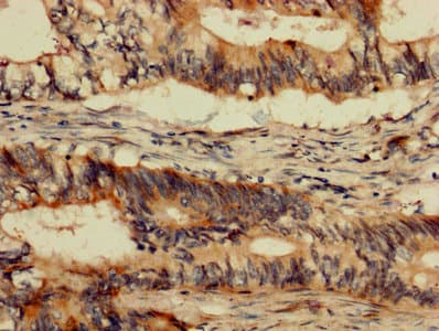 ABL1 / c-ABL Antibody