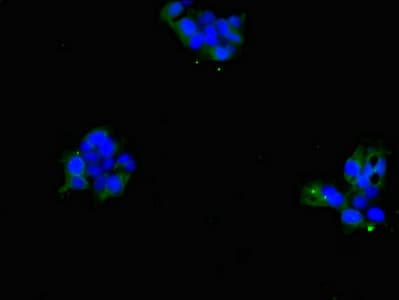 Polyclonal Rabbit anti-Human SLC4A7 Antibody (IHC, IF)