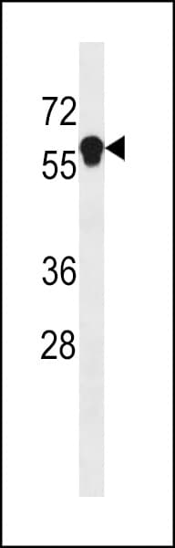 ANKDD1B Antibody (aa494-520)
