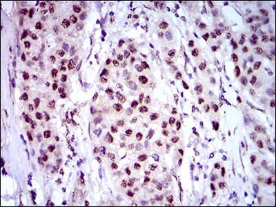 Monoclonal Mouse anti-Human NAPSA / NAPA / Napsin A Antibody (clone 10C4B8, aa20-158, IHC, WB)
