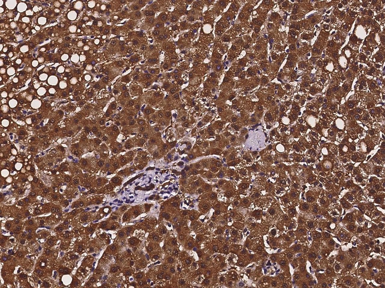 Polyclonal Rabbit anti-Human CRYZ Antibody (IHC)