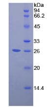 Human Pepsinogen A Protein (Recombinant His)