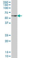 IHC-plus™ Monoclonal Mouse anti-Human PAX7 Antibody (clone 1E12, IHC, WB)