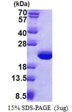 Human TPPP3 Protein (Recombinant His)
