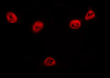 Polyclonal Rabbit anti-Human NUB1 Antibody (IHC, IF, WB)