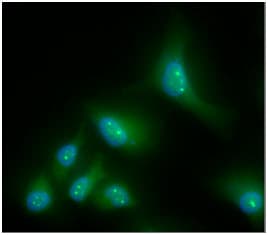 CBR / CBR1 Antibody (clone AT2D6)