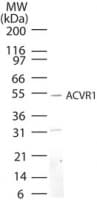 IHC-plus™ ALK2 / ACVR1 Antibody (aa496-509)