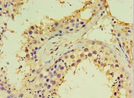 DDX39 Antibody (aa178-427)