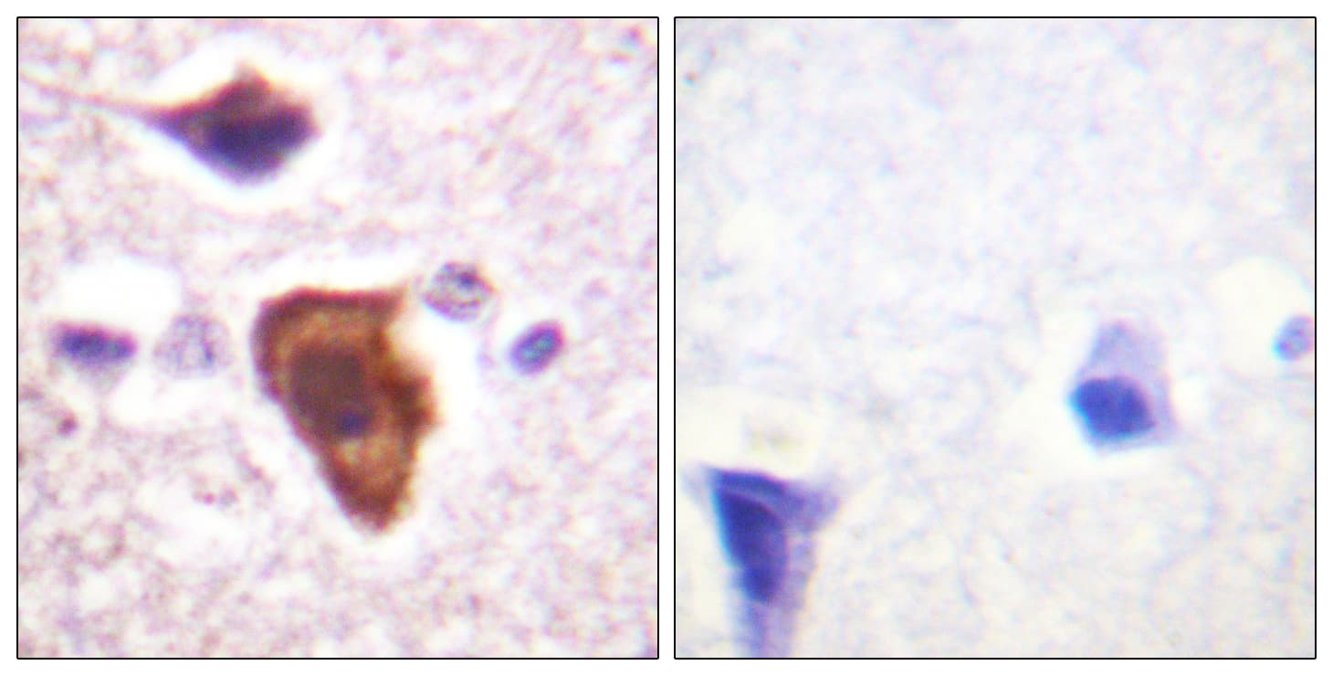 Polyclonal Rabbit anti-Human C5AR1 / CD88 / C5a Receptor Antibody (aa301-350, IHC, IF, WB)