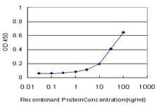 Monoclonal Mouse anti-Human ALDH3A1 Antibody (clone 2G4)