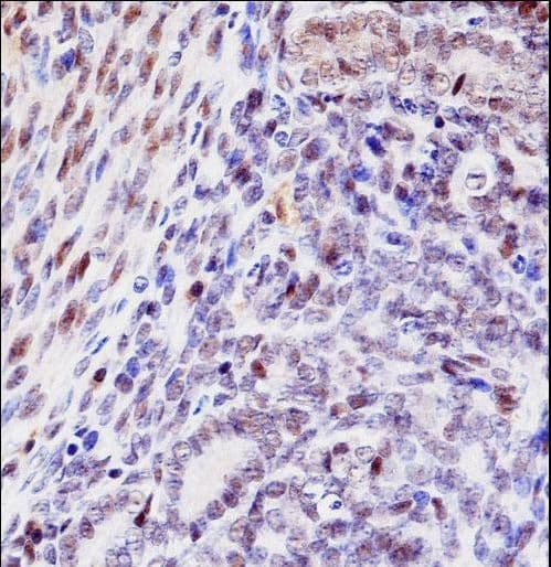 IHC-plus™ HOXD10 Antibody (aa201-230)