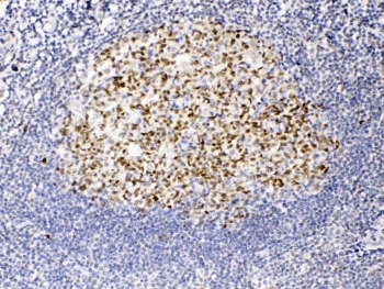TERF2 / TRF2 Antibody