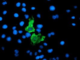 PathPlus™ F13A1 / Factor XIIIa Antibody (clone 1H2)