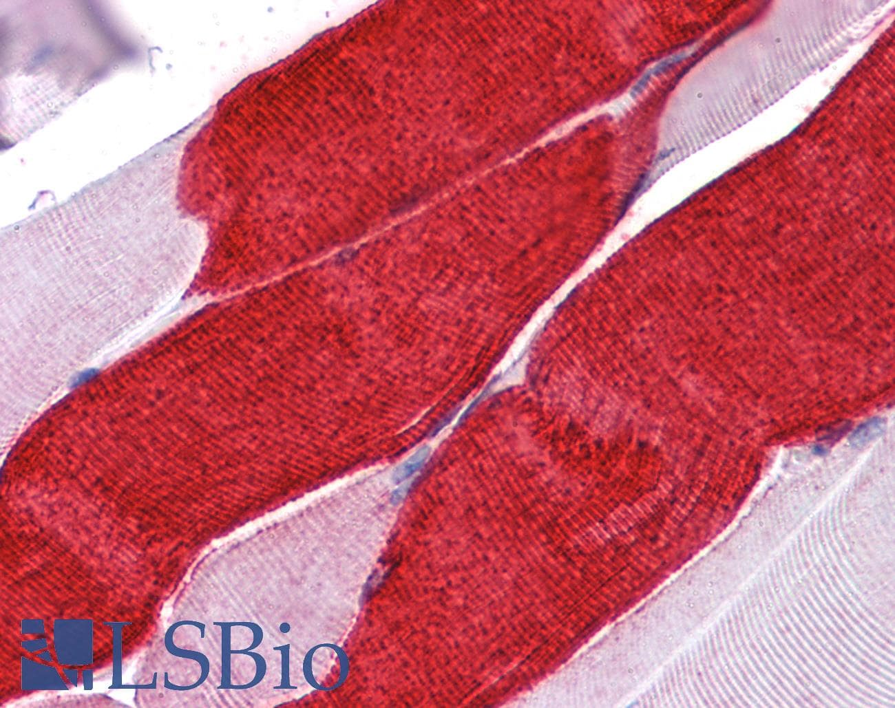 IHC-plus™ MYL3 Antibody (aa2-195, clone 7C1)