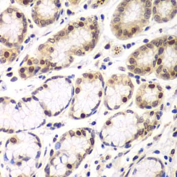 RNF2 / RING2 / RING1B Antibody