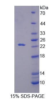 Mouse RGS10 Protein (Recombinant)