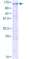 Human ZFYVE9 / SARA Protein (Recombinant GST)