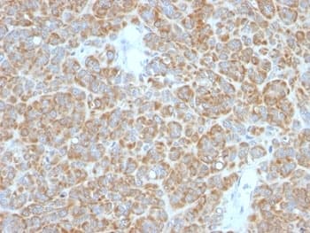 BCL2 / Bcl-2 Antibody (clone BCL2/782 + BCL2/796, Ready-to-Use)