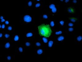 PSMD2 Antibody (clone OTI1D1)