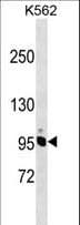 IHC-plus™ Polyclonal Rabbit anti-Human NCAPH / CAP-H Antibody (aa354-382, IHC, WB)