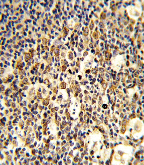 FCGR1B Antibody (aa248-276)
